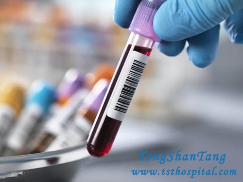 When Creatinine Is Elevated, Do These Two Things Immediately to Prevent Uremia