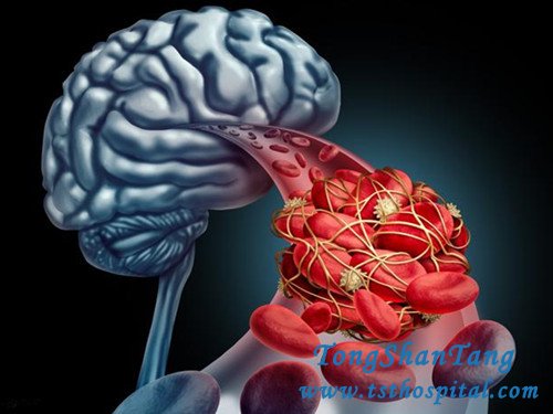 3 Most Dangerous Moments of Kidney Disease
