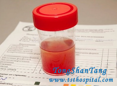 Why Is There Visible Blood in Urine with IgA Nephropathy