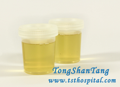 3 Ways to Help You Fight Against Refractory Proteinuria