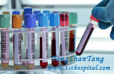 How to Test for Lupus Nephritis