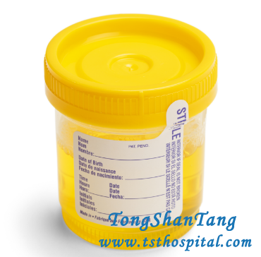 4 Factors that Trigger Relapse of Proteinuria