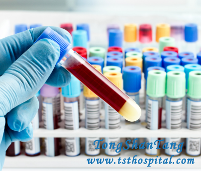 How to Test for PKD