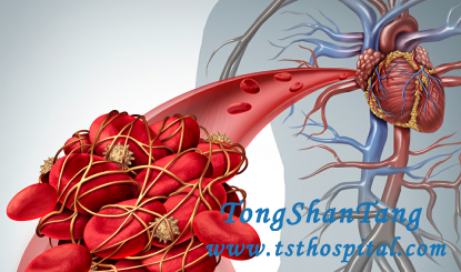 Why Does Blood Clot Present in Nephrotic Syndrome